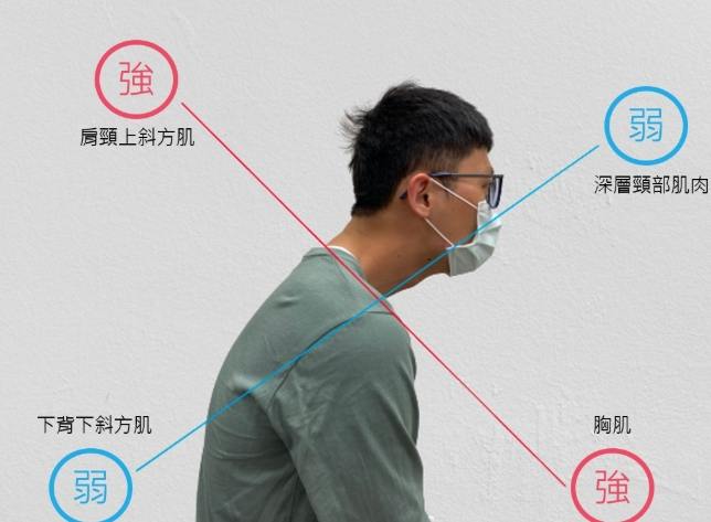 頸部姿勢矯正 頸部姿勢矯正