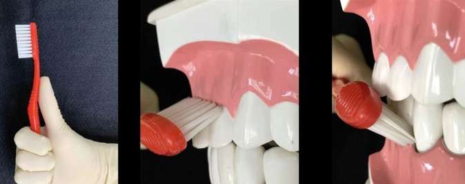 牙齦護理 牙齦護理