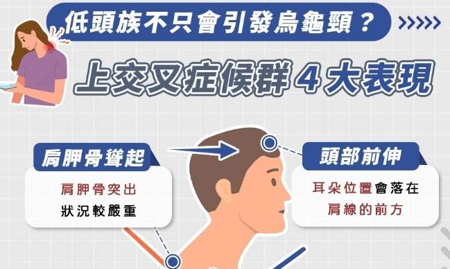 頸部姿勢矯正 頸部姿勢矯正