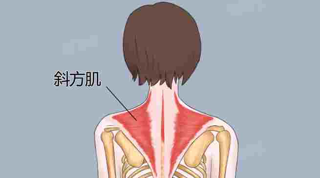 斜方肌酸痛原因