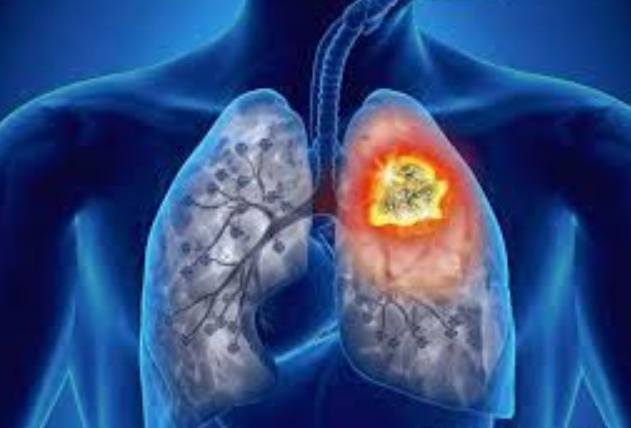戒菸肺部恢复