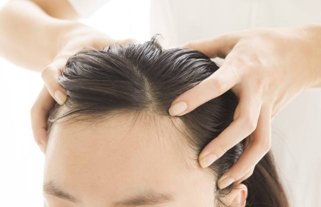 掉髮治療 掉髮治療