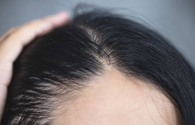 掉髮原因
