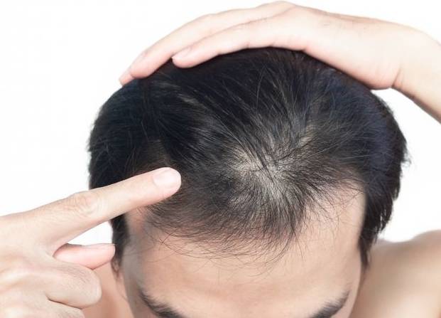 防脫髮飲食