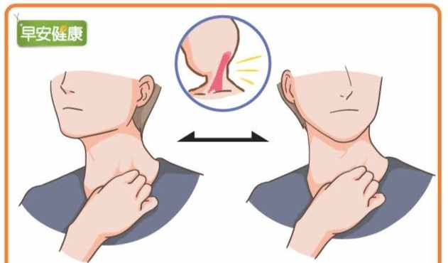烏龜頸改善 烏龜頸改善