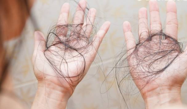 掉髮原因與預防