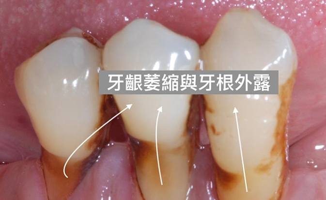 正確刷牙方法 正確刷牙方法