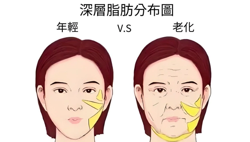 減少臉部脂肪方法