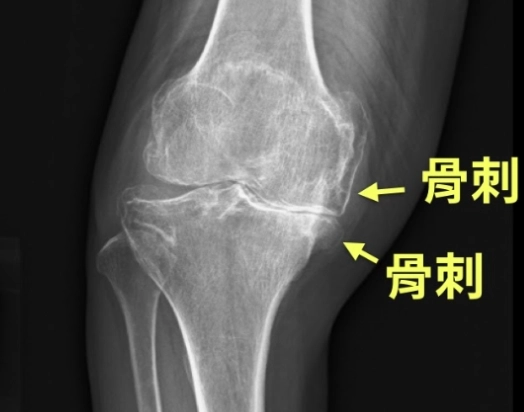 膝蓋刺青設計 膝蓋刺青設計
