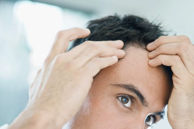 男性掉髮因素 男性掉髮因素