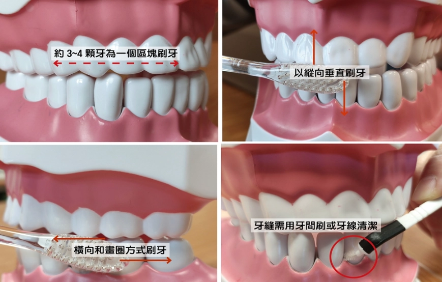 牙齒清潔方法