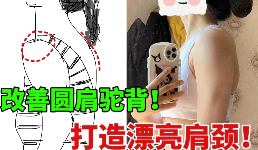 圓肩矯正 圓肩矯正