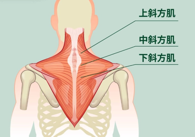 斜方肌疼痛治療