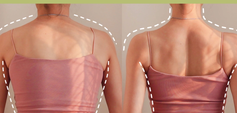 圓肩原因 圓肩原因