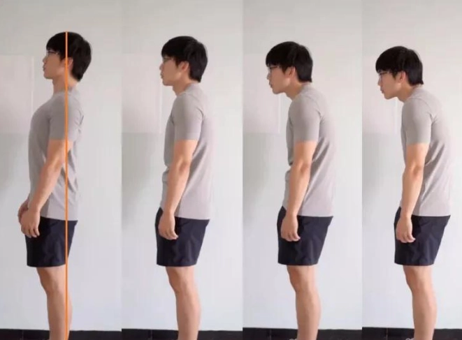 改善駝背運動