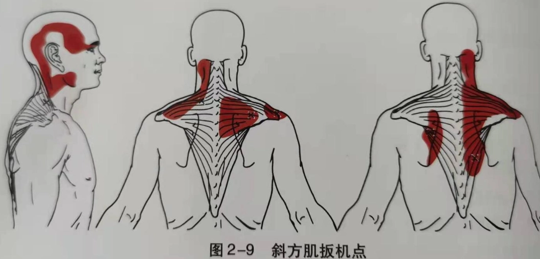 肩頸酸痛解決 肩頸酸痛解決
