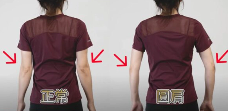 圓肩矯正 圓肩矯正