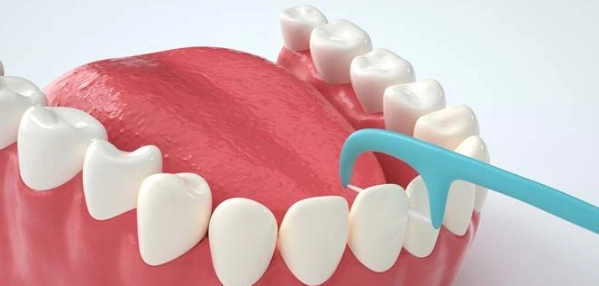 牙線好處