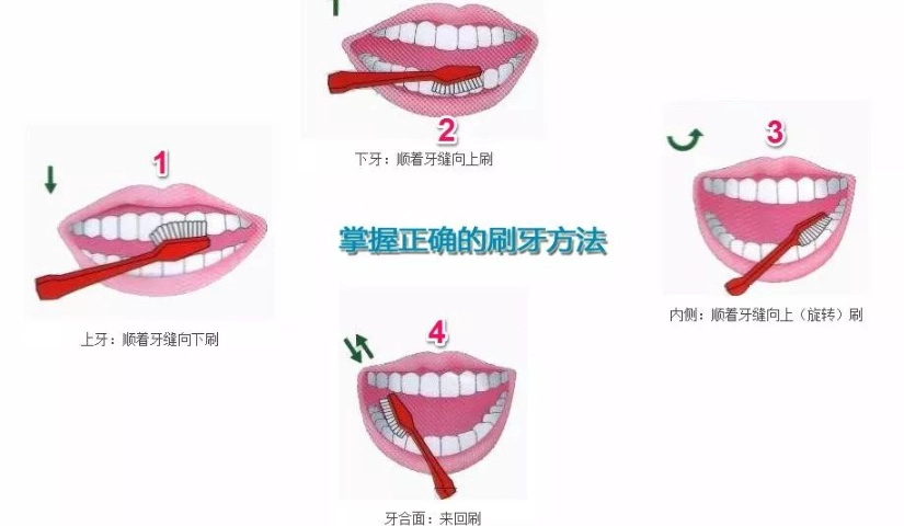 貝氏刷牙法步驟