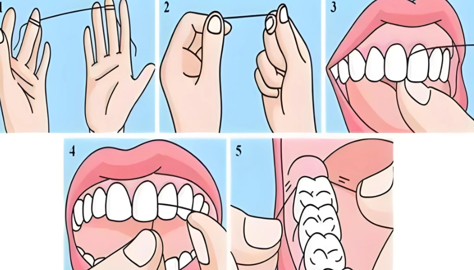 牙線多久用一次 牙線多久用一次