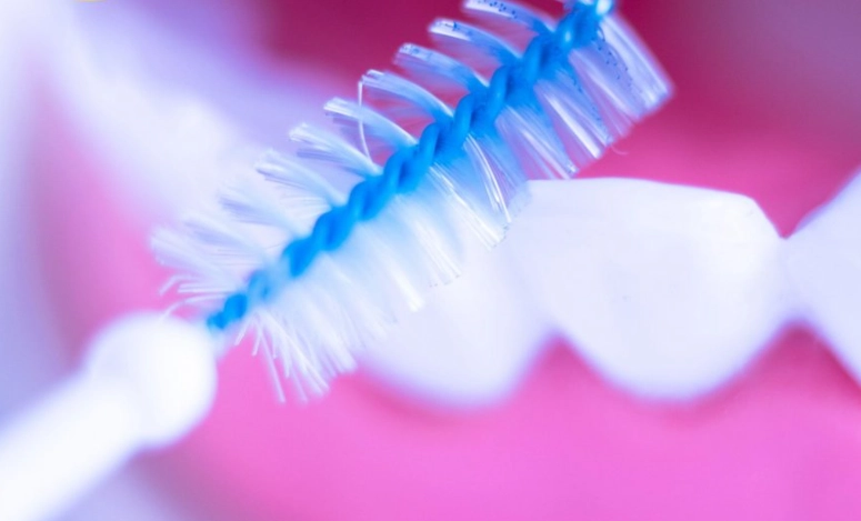 牙間刷壞處 牙間刷壞處