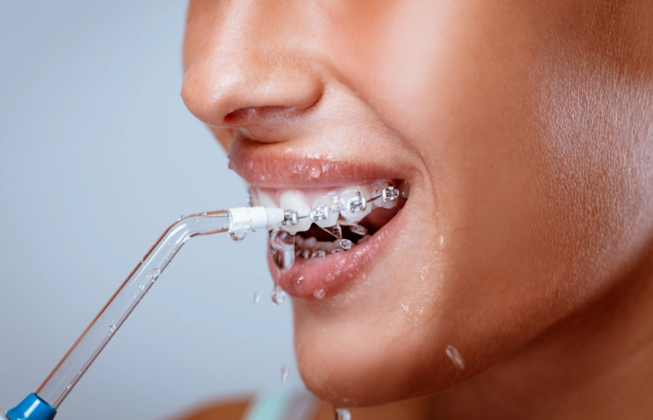 水牙線使用順序