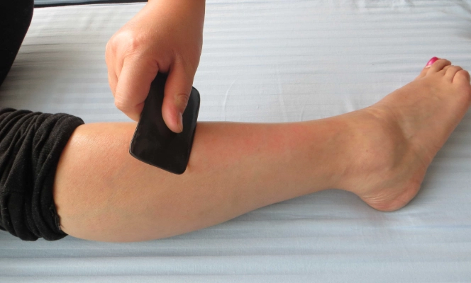 刮痧後疹子處理