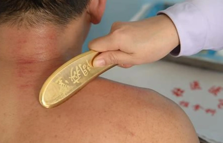 背部刮痧技巧 背部刮痧技巧