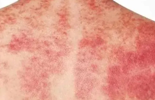 刮痧脊椎好處 刮痧脊椎好處