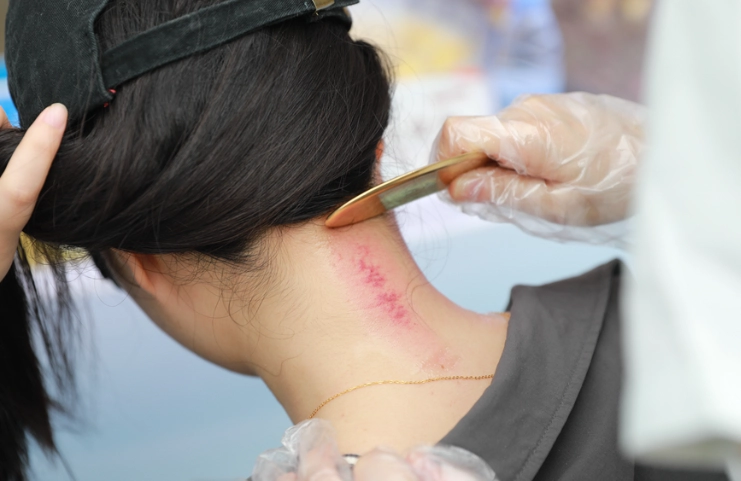 刮痧時間長短 刮痧時間長短