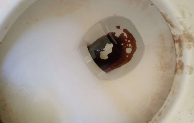 馬桶霉斑處理 馬桶霉斑處理