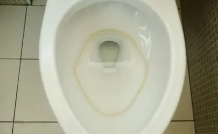 馬桶霉斑處理 馬桶霉斑處理