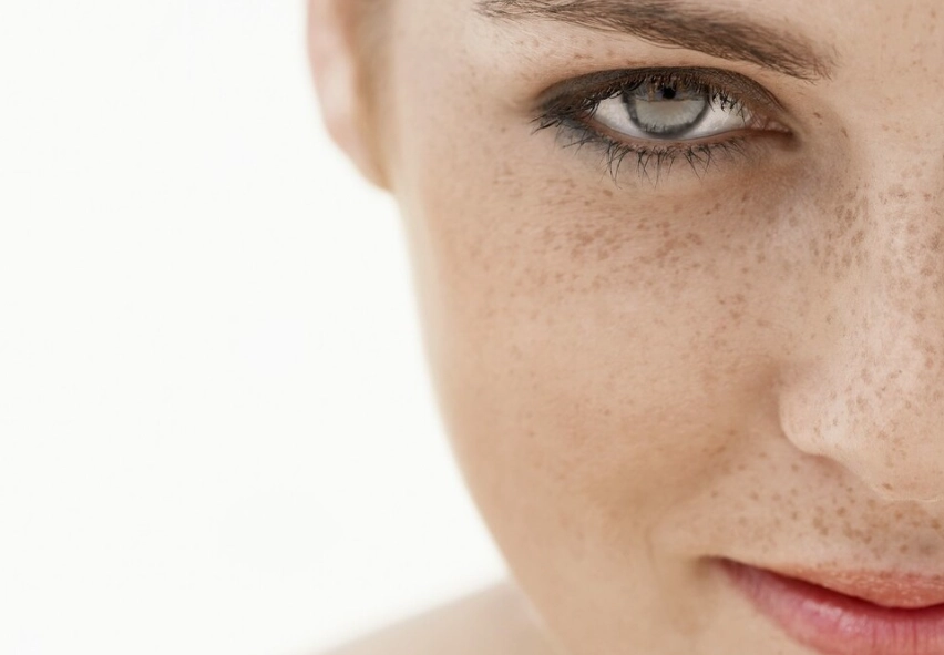 臉上黑黑一塊原因 臉上黑黑一塊原因