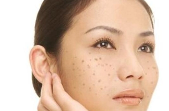 面部斑點心臟健康