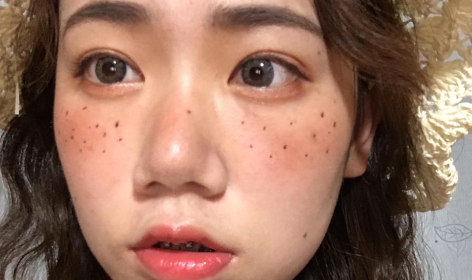 臉上黑斑治療 臉上黑斑治療