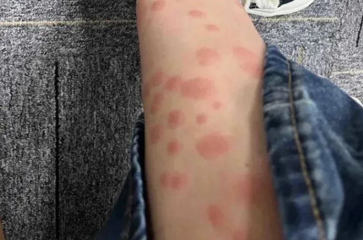 防蚊方法 防蚊方法