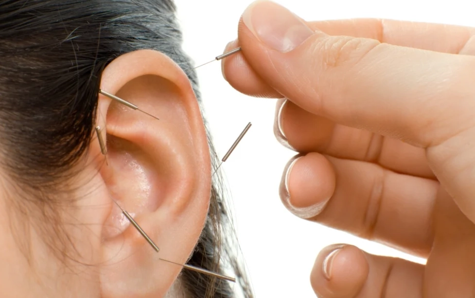 針灸耳鳴穴道