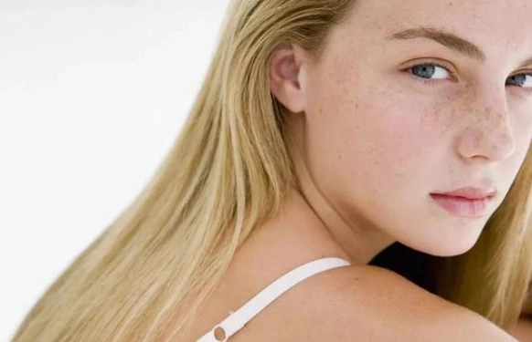 皮膚色素沉澱 皮膚色素沉澱