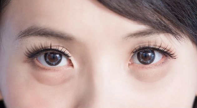眼袋怎麼消除