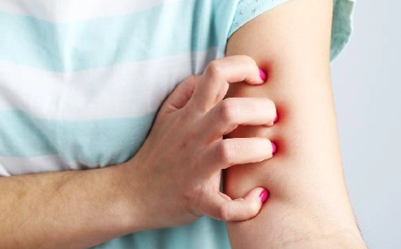 止痒技巧 止痒技巧