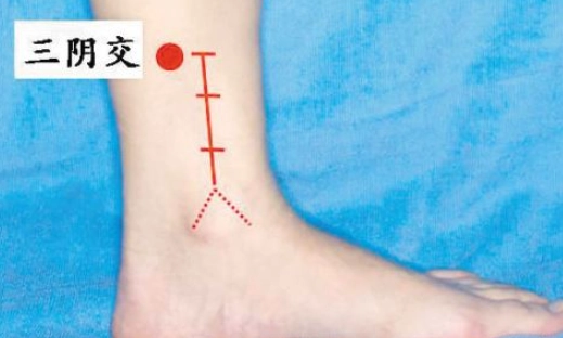 手脚冰冷改善穴位 手脚冰冷改善穴位