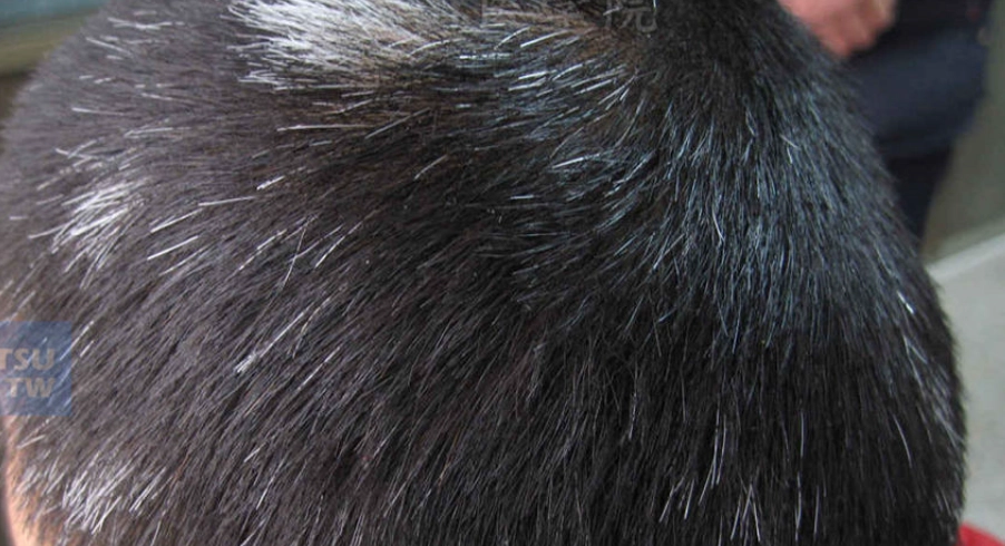 頭皮健康檢查