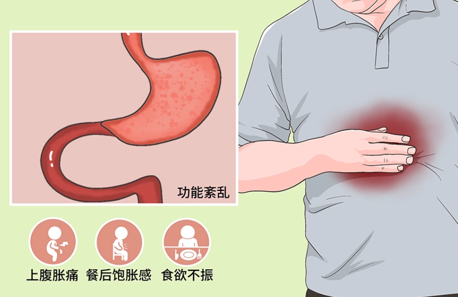 胃部不適原因