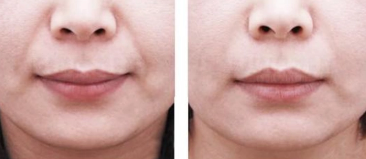 暗沉改善 暗沉改善