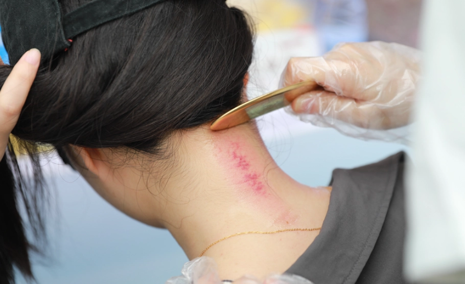 刮痧穴位 刮痧穴位