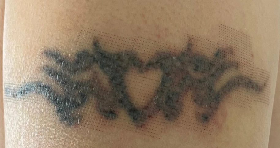 刺青結厚痂護理