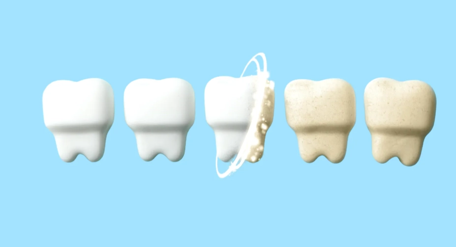 琺瑯質受損 琺瑯質受損