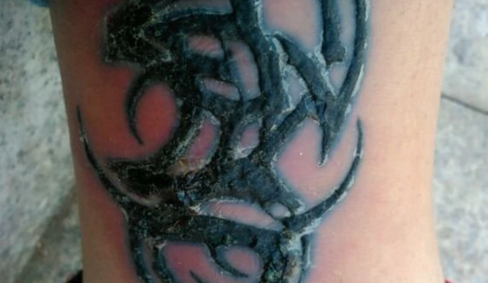 刺青後保養方法