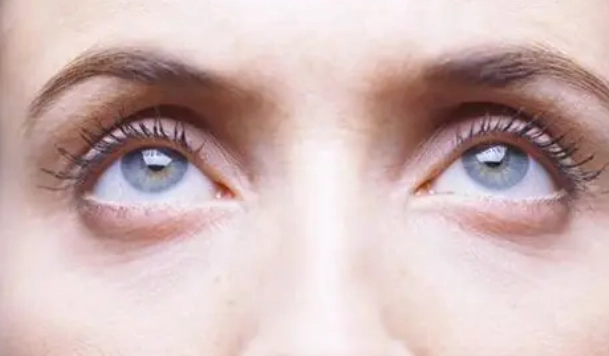 眼睛疲勞解決方法