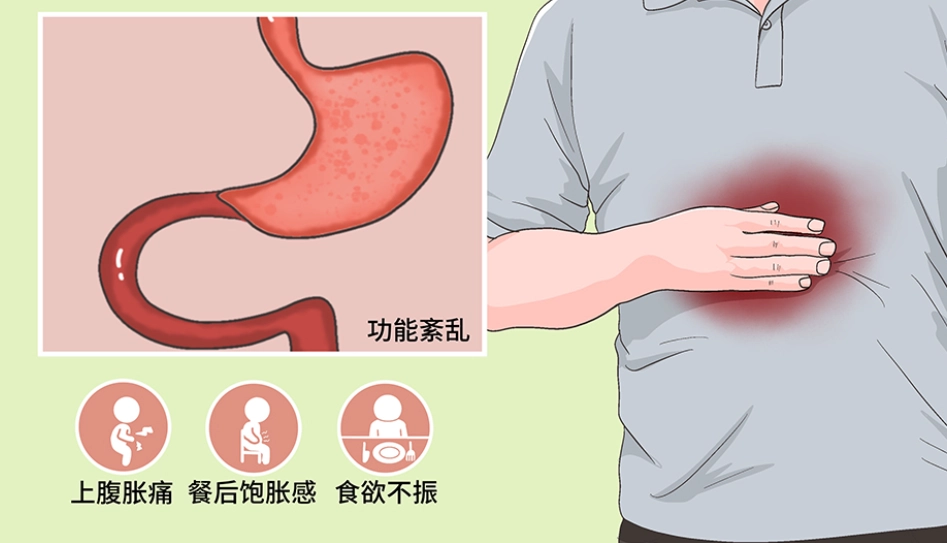 胃部不適治療